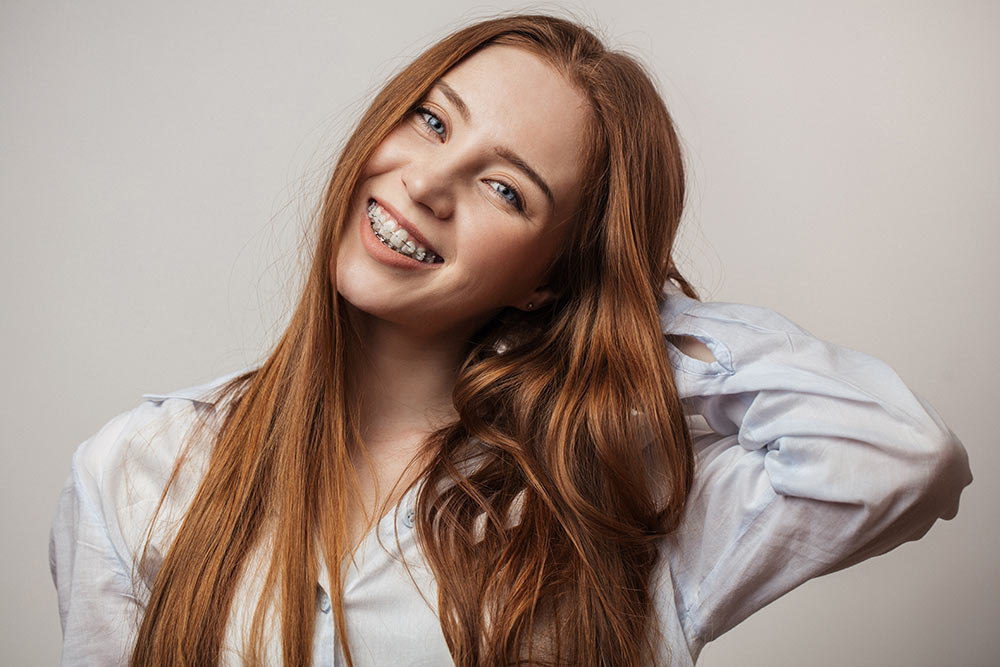 braces-ceramic braces-ceramic